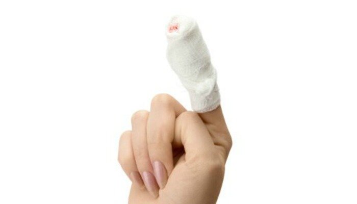 Опухание пальца после пореза
