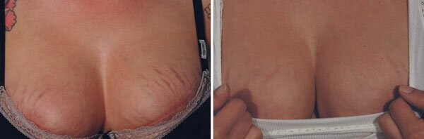 Фото: до и после микротоковой терапии